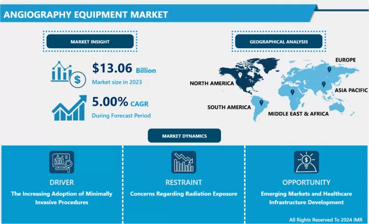 Angiography Equipment Market - Size, Share, Trend Analysis