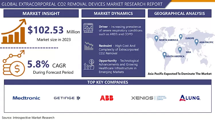 Extracorporeal CO2 Removal Devices: Market Overview & Growth
