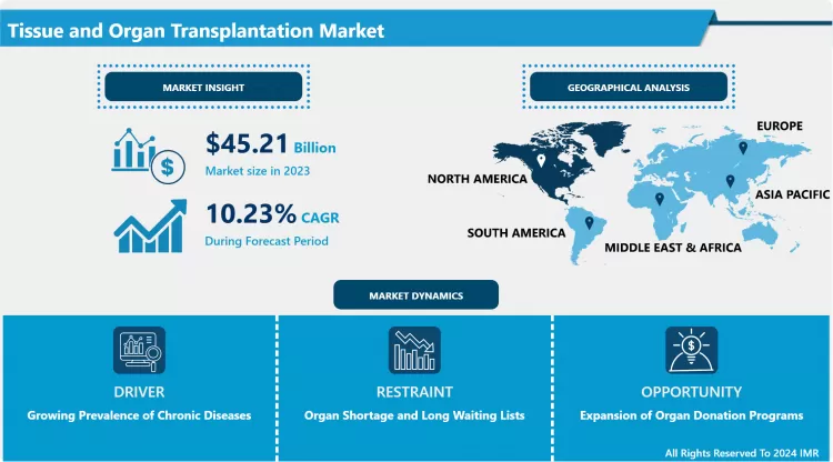 Tissue And Organ Transplantation Market - Industry Trends